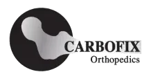 CarboFix Orthopedics logo — inteRFace R&D client
